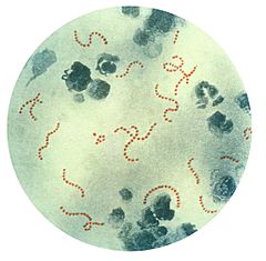 240px-Streptococcus_pyogenes_01